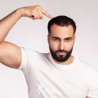 Hair Transplant in Merida, Mexico: What Should Patients Compare Before Choosing Care?